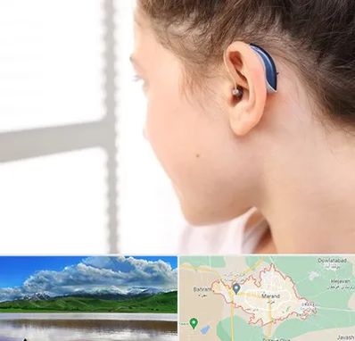 تجویز سمعک در مرند
