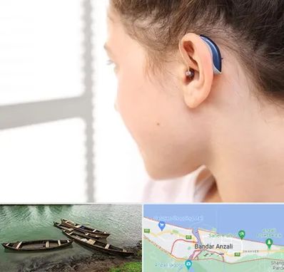 تجویز سمعک در بندر انزلی
