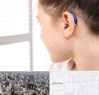 تجویز سمعک در جیحون