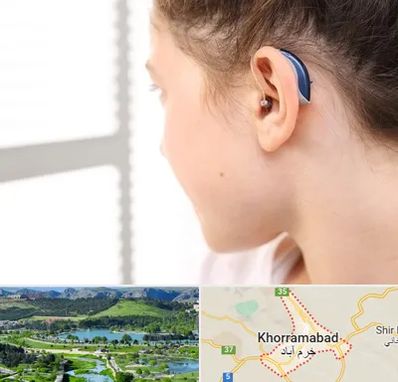 تجویز سمعک در خرم آباد