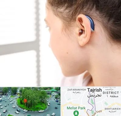 تجویز سمعک در تجریش 
