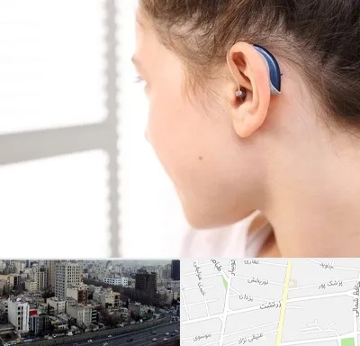 تجویز سمعک در زرتشت
