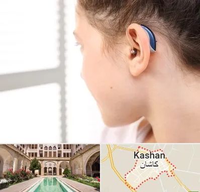تجویز سمعک در کاشان