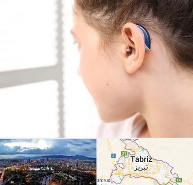 تجویز سمعک در تبریز