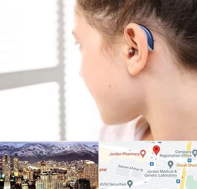 تجویز سمعک در جردن 