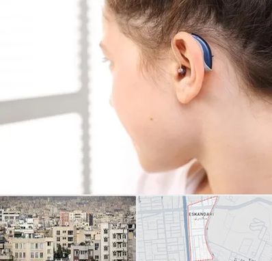 تجویز سمعک در اسکندری