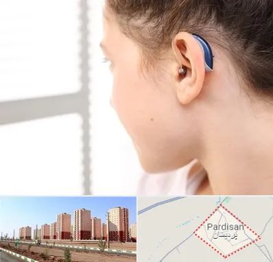تجویز سمعک در پردیسان قم