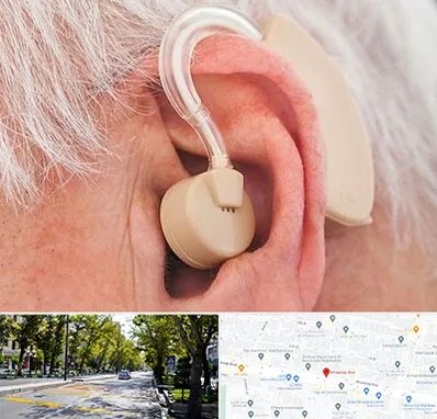 خرید سمعک در میرداماد 