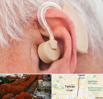 خرید سمعک در ولیعصر 