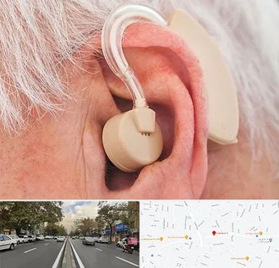 خرید سمعک در دولت 