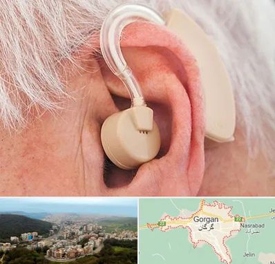 خرید سمعک در گرگان