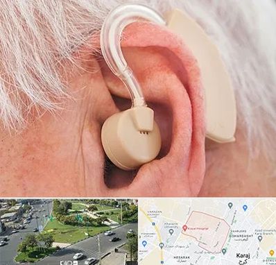 خرید سمعک در شاهین ویلا کرج 