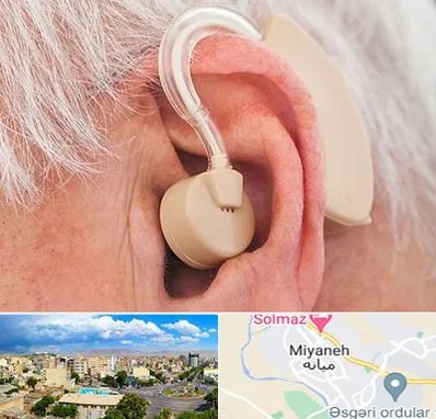 خرید سمعک در میانه