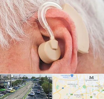 خرید سمعک در جنوب تهران 