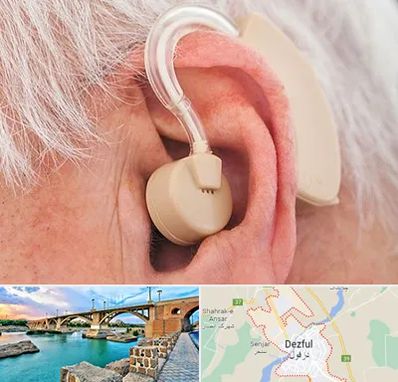 خرید سمعک در دزفول