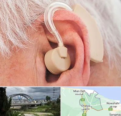 خرید سمعک در چالوس