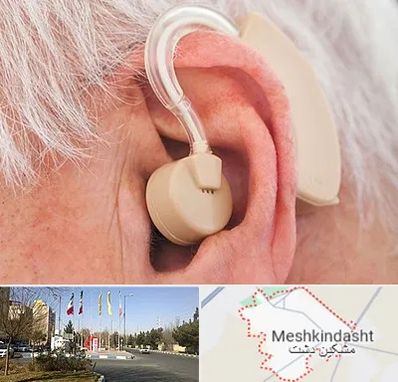 خرید سمعک در مشکین دشت