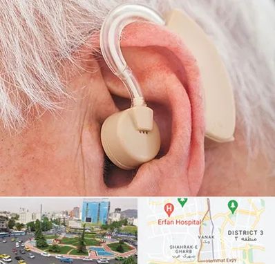 خرید سمعک در ونک 