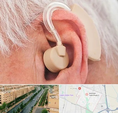 خرید سمعک در فاز سه اندیشه