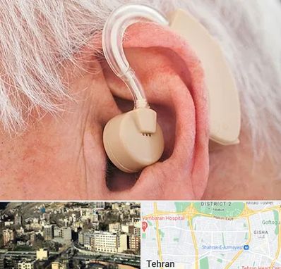 خرید سمعک در مرزداران 