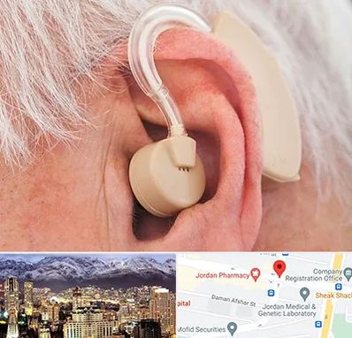 خرید سمعک در جردن 