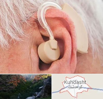 خرید سمعک در کوهدشت