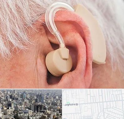 خرید سمعک در جیحون