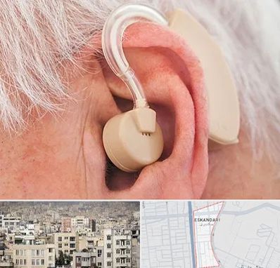 خرید سمعک در اسکندری