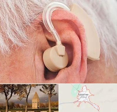 خرید سمعک در تویسرکان