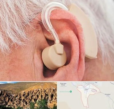 خرید سمعک در اسکو