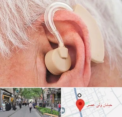 خرید سمعک در ولیعصر شهریار