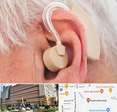 خرید سمعک در سهروردی 