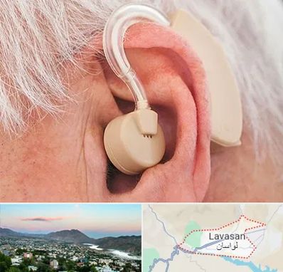 خرید سمعک در لواسان