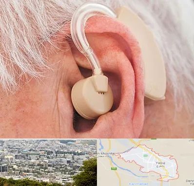 خرید سمعک در یاسوج