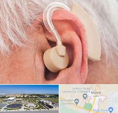 خرید سمعک در ملارد