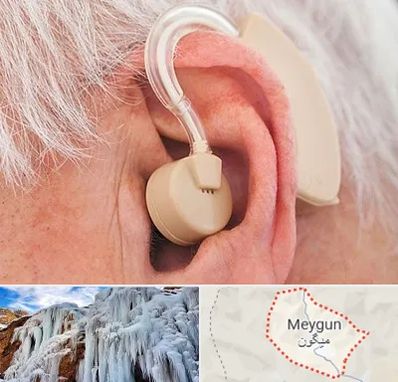 خرید سمعک در میگون