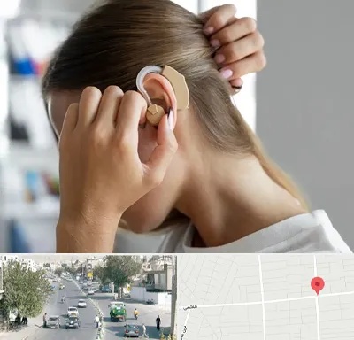 فروش اقساطی سمعک در هاشمی