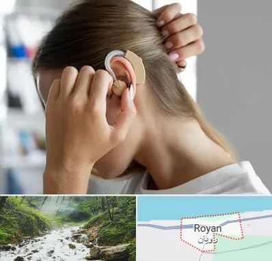فروش اقساطی سمعک در رویان