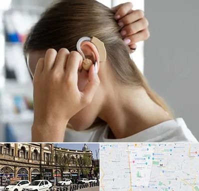 فروش اقساطی سمعک در منطقه 11 تهران 