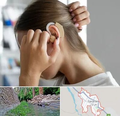 فروش اقساطی سمعک در سراوان