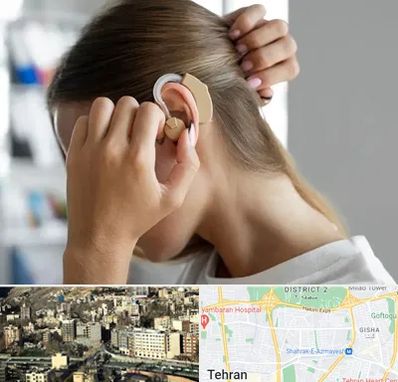 فروش اقساطی سمعک در مرزداران 