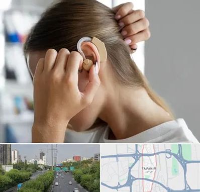 فروش اقساطی سمعک در توانیر