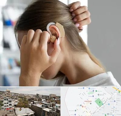 فروش اقساطی سمعک در شمیران نو 