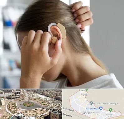 فروش اقساطی سمعک در پرند