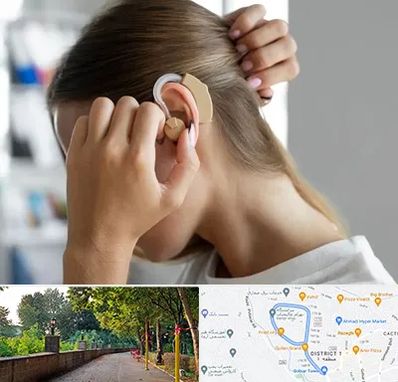 فروش اقساطی سمعک در فلکه گاز رشت 