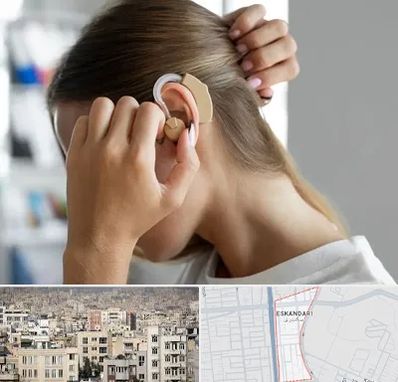 فروش اقساطی سمعک در اسکندری