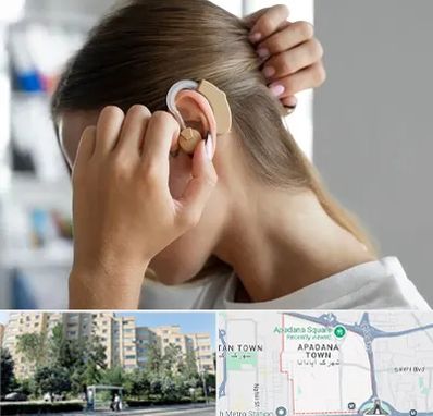 فروش اقساطی سمعک در آپادانا