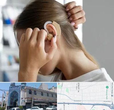 فروش اقساطی سمعک در بلوار ابوذر