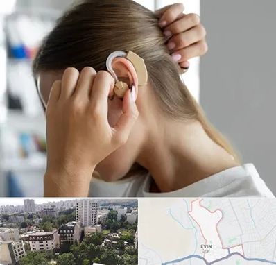 فروش اقساطی سمعک در اوین