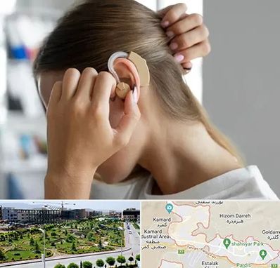 فروش اقساطی سمعک در پردیس